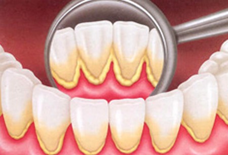 Periodontia