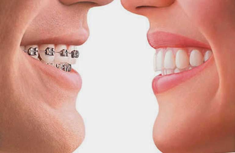 Ortodontia e Ortopedia Facial
