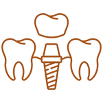 alphaface-inicio-Implantes Dentários